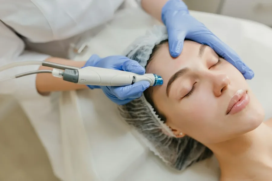 Carbon Laser Peel & Vampire Facial in Varanasi — Dr. Ankesh Seth