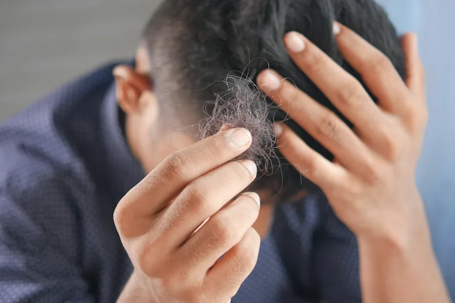 Hair Fall / Hair Loss Treatment in Varanasi — Dr. Ankesh Seth