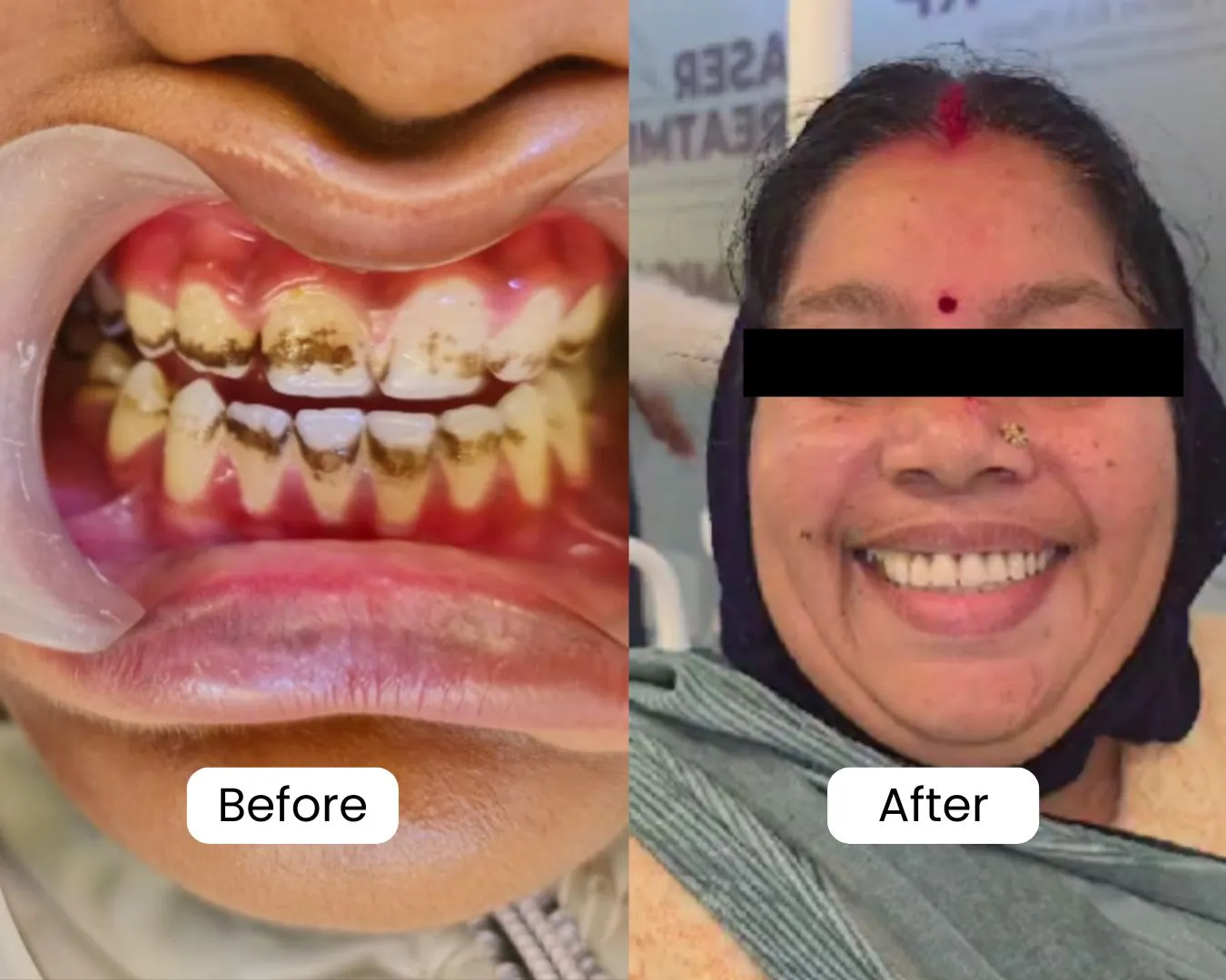 Patient before and after result 17
