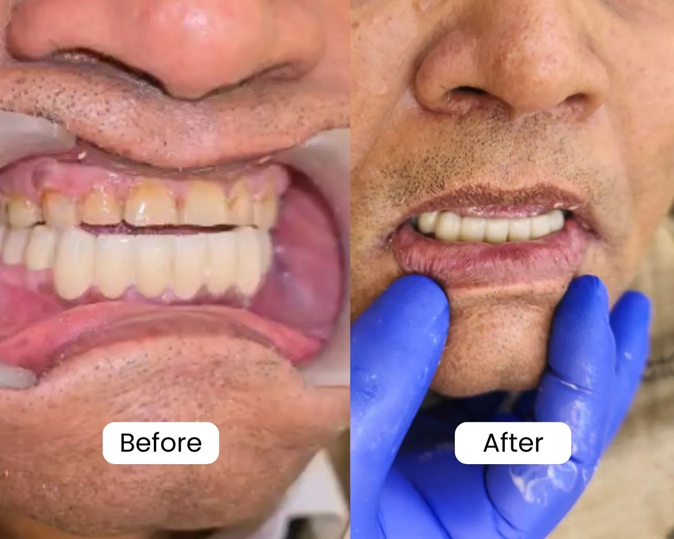 Patient before and after result 19